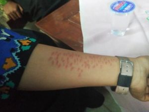 Bukan Torpedo Anak Sayat Tangan Dengan Silet, Penyebabnya Anak Teropsesi Tontonan Youtube