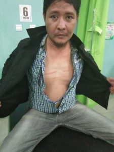 Aniaya Jurnalis Saat Meliput, Oknum Aparat Kampung Rejo Sari Dilaporkan Ke Polisi