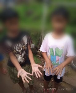 Dampak Perusahaan Tambang KBU-NUP-LAB di Pesawaran, Banyak Warga Kena Penyakit dan Gatal-Gatal Akibat Air Tercemar